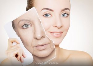 نظرات در مورد تزریق چربی به صورت