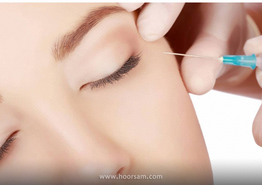 کاهش مدت تاثیر گذاری تزریق ژل