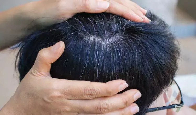 تأثیر لیزر بر مو‌های سفید