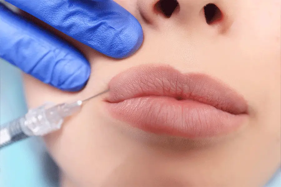 انواع مدل تزریق ژل لب