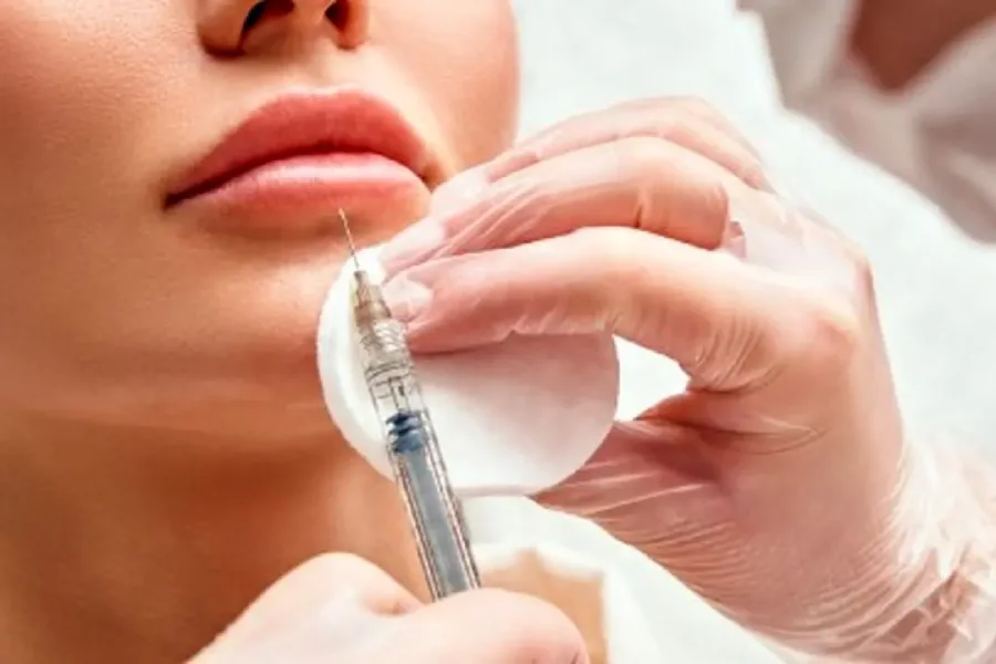چگونه ورم بعد از تزریق ژل را به سرعت کاهش دهیم